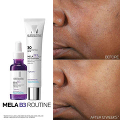 Mela B3 Dark Spot Serum & Mela B3 UV Daily Moisturizer With SPF 30